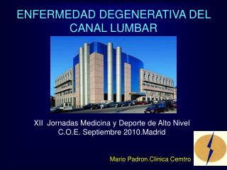 ENFERMEDAD DEGENERATIVA DEL CANAL LUMBAR