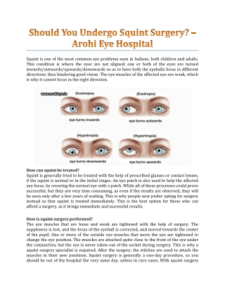 Should You Undergo Squint Surgery? - Arohi Eye Hospital
