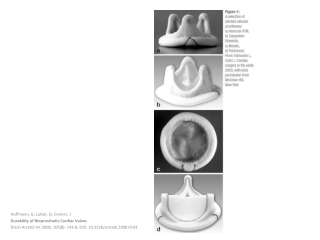 Hoffmann, G; Lutter, G; Cremer, J Durability  of  Bioprosthetic Cardiac Valves