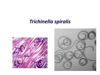 Trichinella spiralis