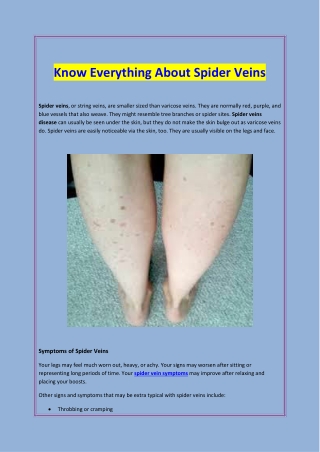 Know Everything About Spider Veins