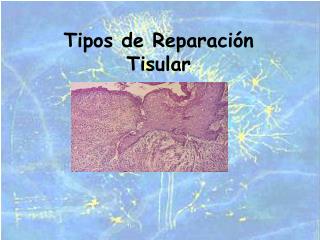 Tipos de Reparación Tisular