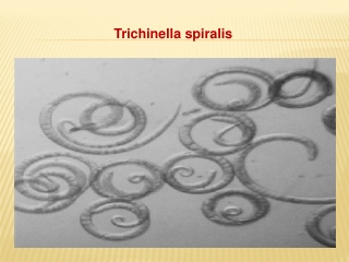 Trichinella spiralis