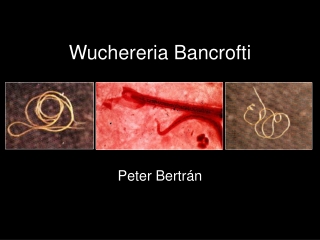 Wuchereria Bancrofti