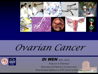 Ovarian Cancer