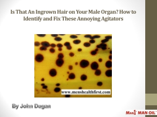 Is That An Ingrown Hair on Your Male Organ? How to Identify and Fix These Annoying Agitators