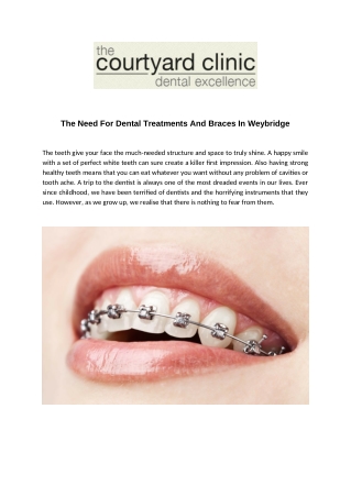 The Need For Dental Treatments And Braces In Weybridge