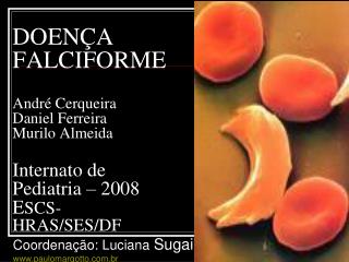 DOENÇA FALCIFORME André Cerqueira Daniel Ferreira Murilo Almeida Internato de Pediatria – 2008 E SCS- HRAS/SES/DF