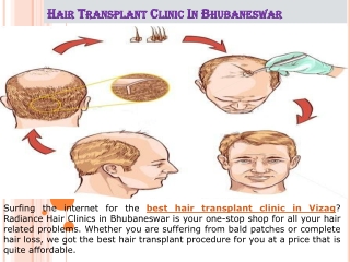 Hair Transplant Clinic In Vizag