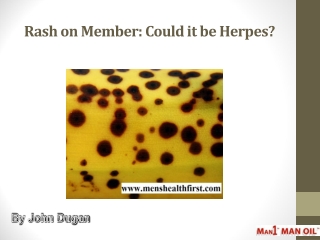 Rash on Member: Could it be Herpes?