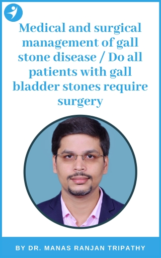Medical and surgical management of gall stone | Gall Bladder Stone Treatment in Bangalore