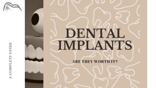 Dental implants: Are they worth it?