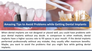 Amazing Tips to Avoid Problems while Getting Dental Implants