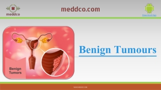 Benign tumors Symptoms Treatment And Prevention | Meddco