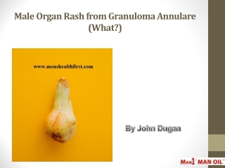 Male Organ Rash from Granuloma Annulare (What?)