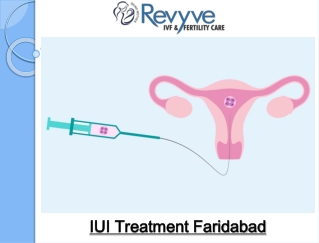 IUI Treatment Faridabad