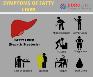 Symptoms Of Fatty Liver (Hepatic Steatosis)