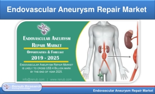 Endovascular Aneurysm Repair Market will be USD 4 Billion by 2025