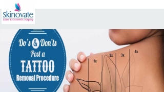 DO’S AND DON’TS POST A TATTOO REMOVAL PROCEDURE