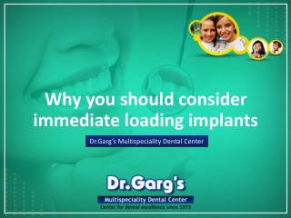 Why you should consider immediate loading implants