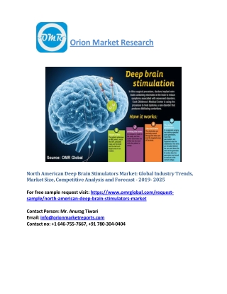 North American Deep Brain Stimulators Market will experience a noticeabl