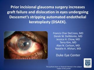 Prior incisional glaucoma surgery increases graft failure and dislocation in eyes undergoing Descemet’s stripping automa