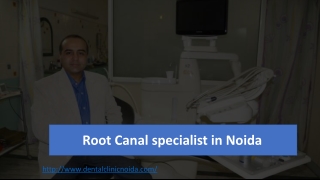 Root Canal Specialist in Noida