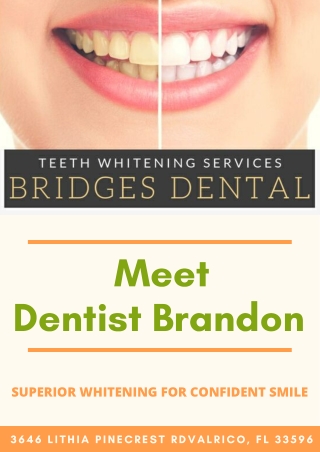 Dentist Brandon - Teeth Whitening for Smile Makeover