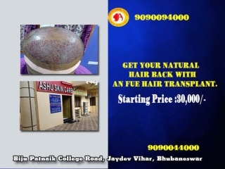 Ashu skin care is the best clinic for hair transplant in bhubaneswar, odisha.