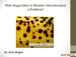 Male Organ Skin: Is Member Discoloration a Problem?
