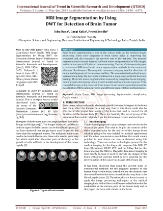 MRI Image Segmentation by using DWT for detection of Brain Tumor