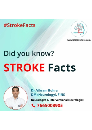 Get to know about Stroke Fact