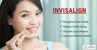 Benefits of INVISALIGN | Best Invisalign Treatment Near me Bangalore