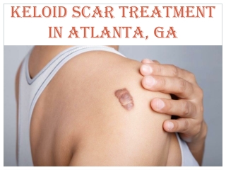 KELOID SCAR TREATMENT IN ATLANTA, GA