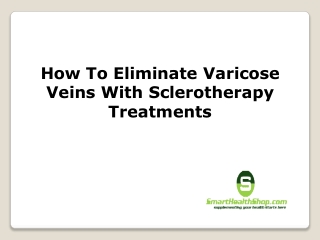 How To Eliminate Varicose Veins With Sclerotherapy Treatments