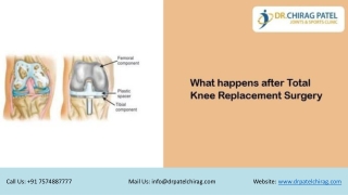 What Happens After Total Knee Replacement Surgery | Dr Chirag Patel