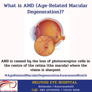 What is AMD (Age-Related Macular Degeneration) - AMD Treatment in Bangalore, Bellandur, Kasavanahalli