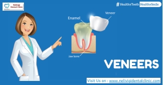 Veneers | Best Dental Veneers and Laminates Treatment in Bellandur