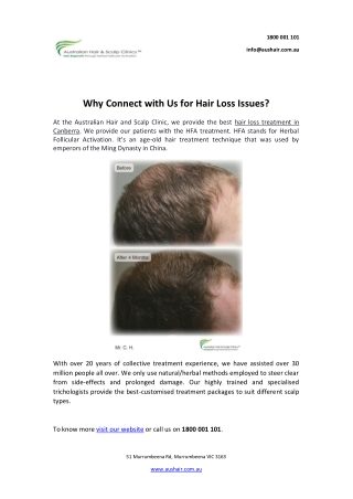 Why Connect with Us for Hair Loss Issues?