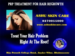 Ashu skin care is best for prp for hair regrowth treatment in bhubaneswar, odisha