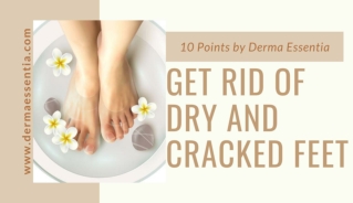 How to Get Rid of Dry and Cracked Feet?