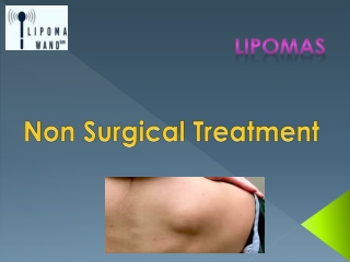 Get a Natural Treatment for Lipoma