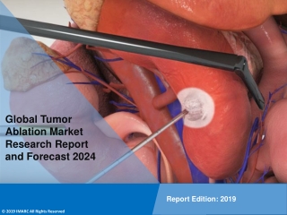 Tumor Ablation Market Research Report, Share, Size, Trends, Growth, Demand and Forecast Till 2024