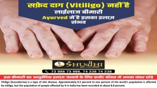 Ayurvedic Treatment for Vitiligo Leucoderma