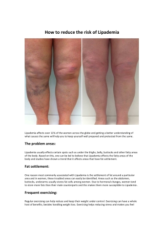 How to reduce the risk of Lipademia