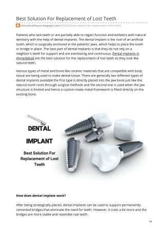 Best Solution For Replacement of Lost Teeth