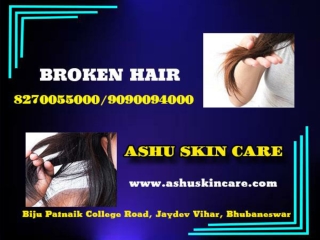 Ashu skin care is best for all type of broken hair treatment in bhubaneswar,odisha