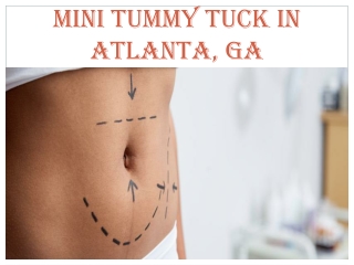 MINI TUMMY TUCK IN ATLANTA, GA