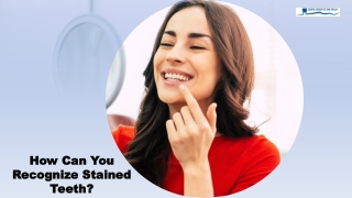 How can you Recognize Stained Teeth