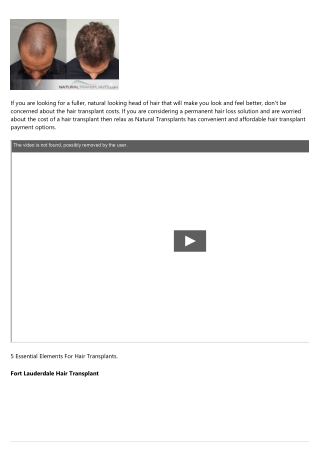 Hair Transplant Reviews